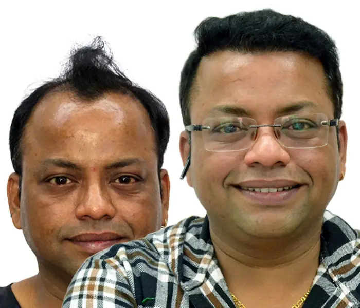New Roots - Hair Transplant Clinic and Skin Specialist Doctor