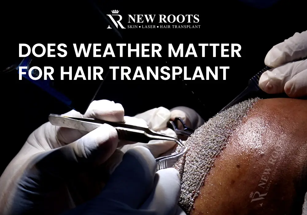 Best weather for hair transplant - New Roots