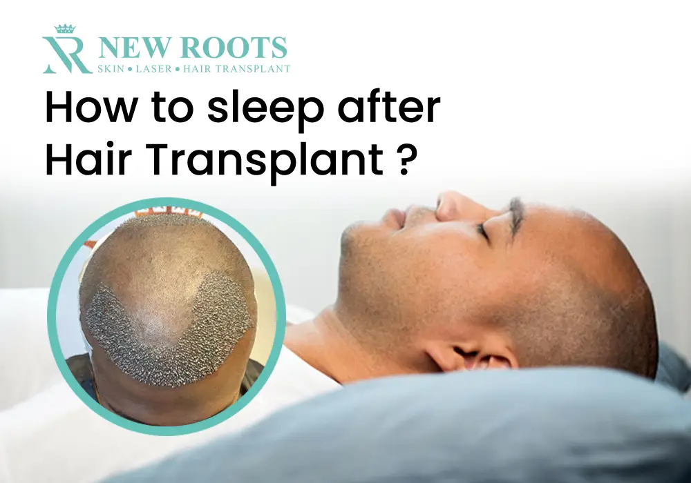 Sleeping tips for hair transplant - New Roots