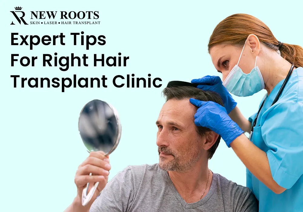 Your guide to the best hair transplant clinic.