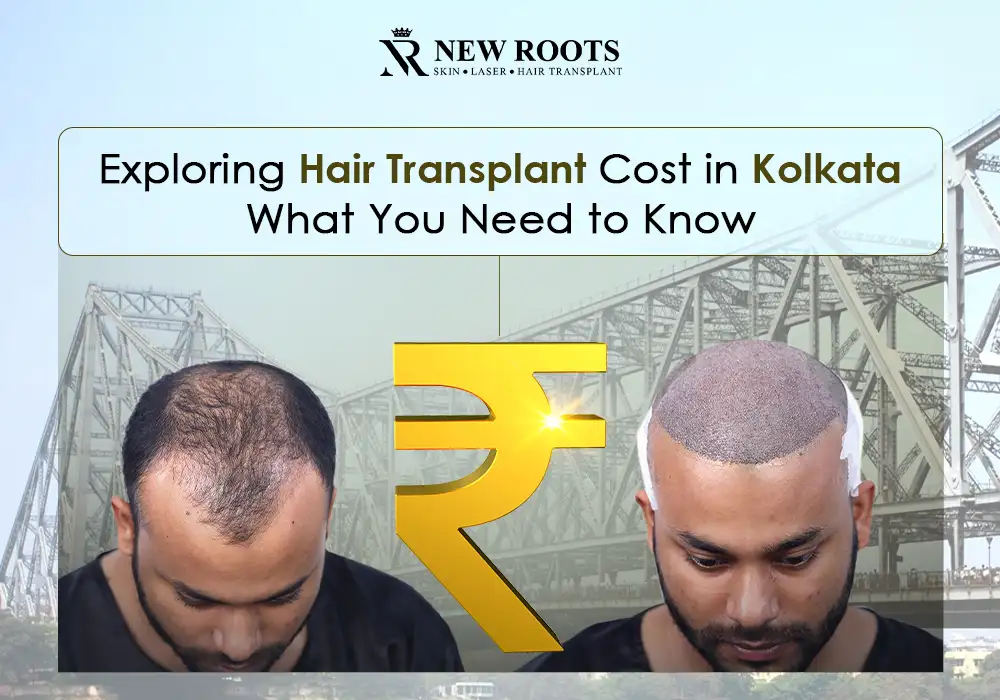 Hair Transplant Cost in Kolkata