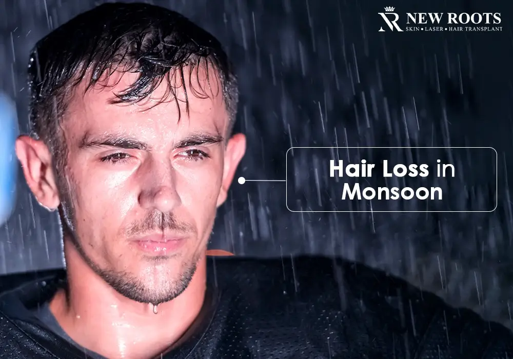 hair loss in monsoon