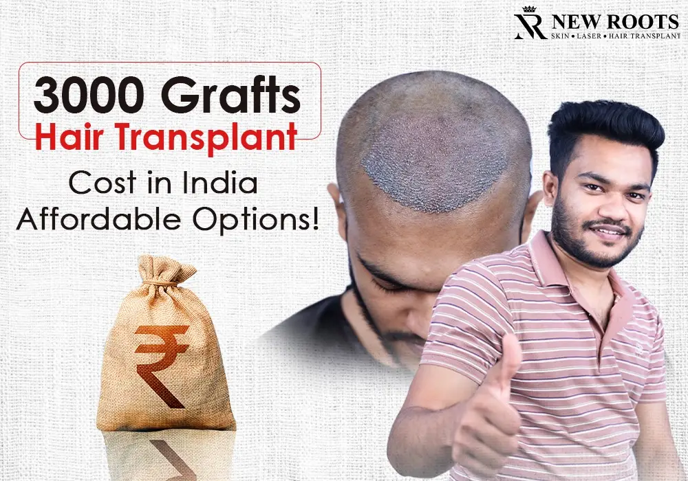 3000 grafts hair transplant cost in india