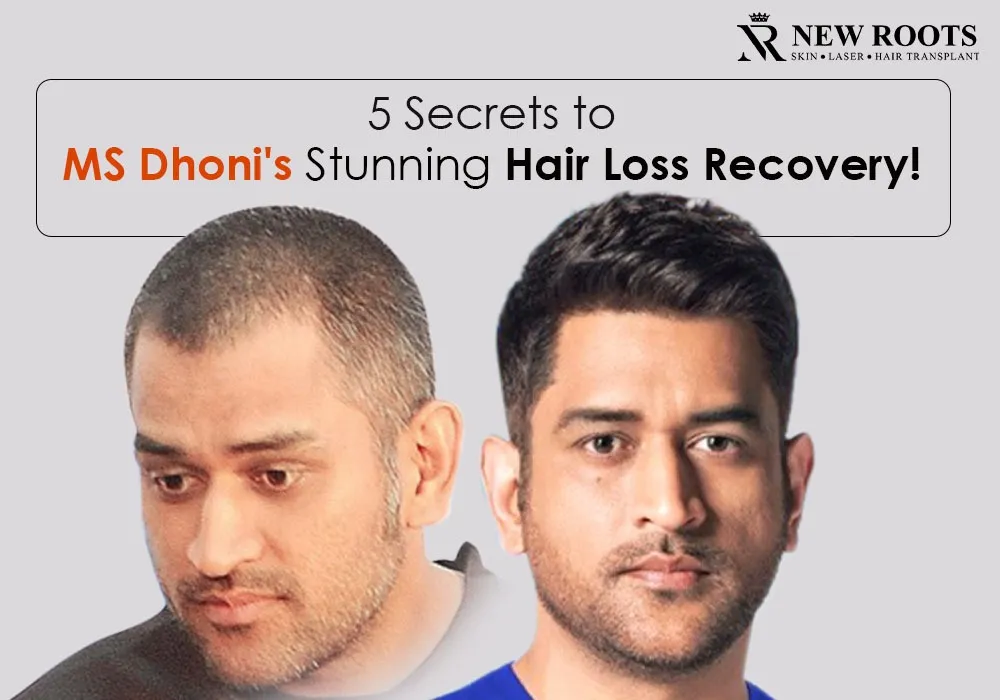 5 Secrets to MS Dhoni's Stunning Hair Loss Recovery