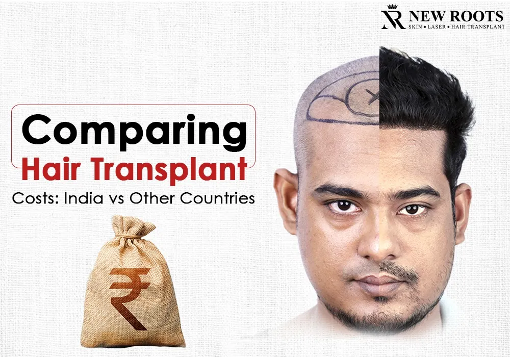 Is Hair Transplant in India Cheaper