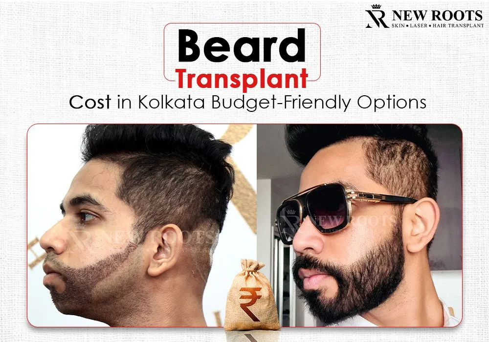 beard transplant cost in kolkata