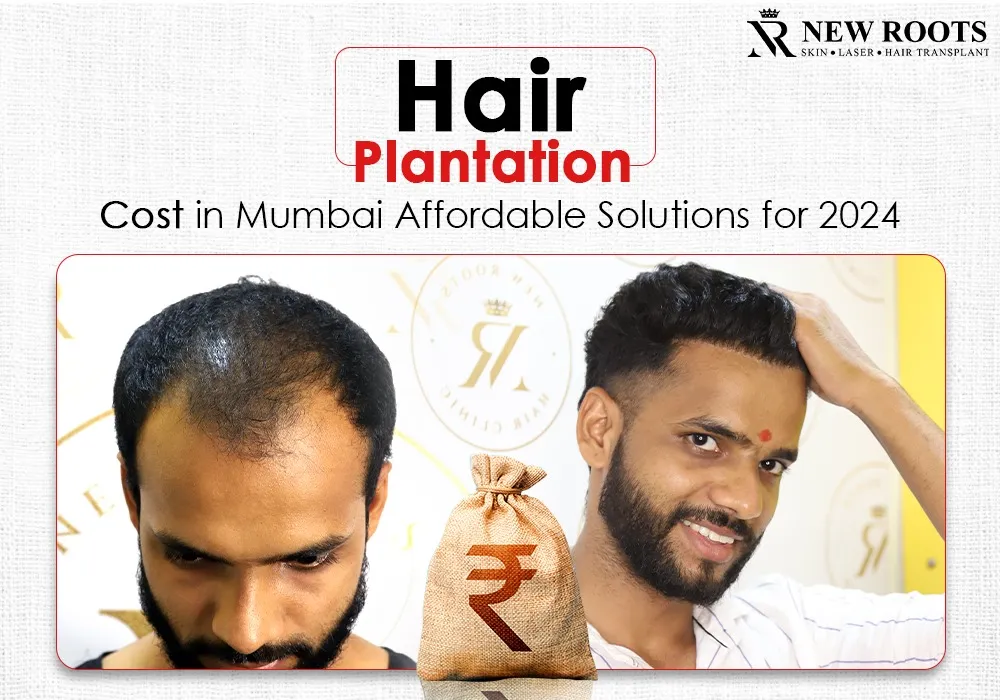 hair plantation cost in mumbai