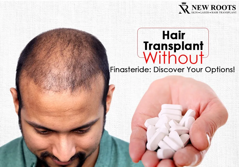 hair transplant without finasteride