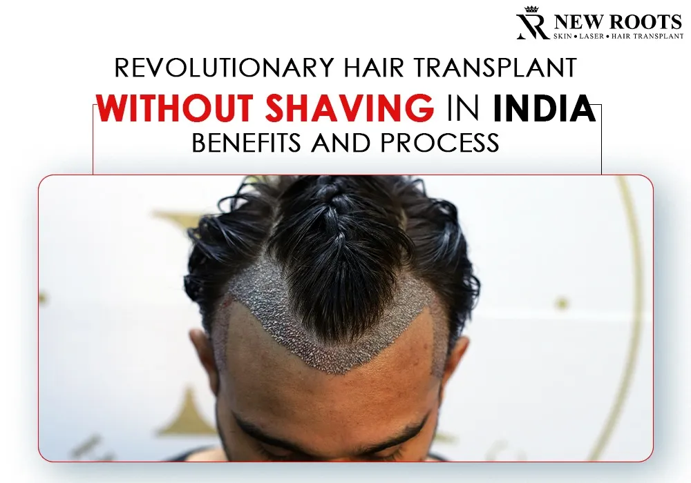 hair transplant without shaving in india