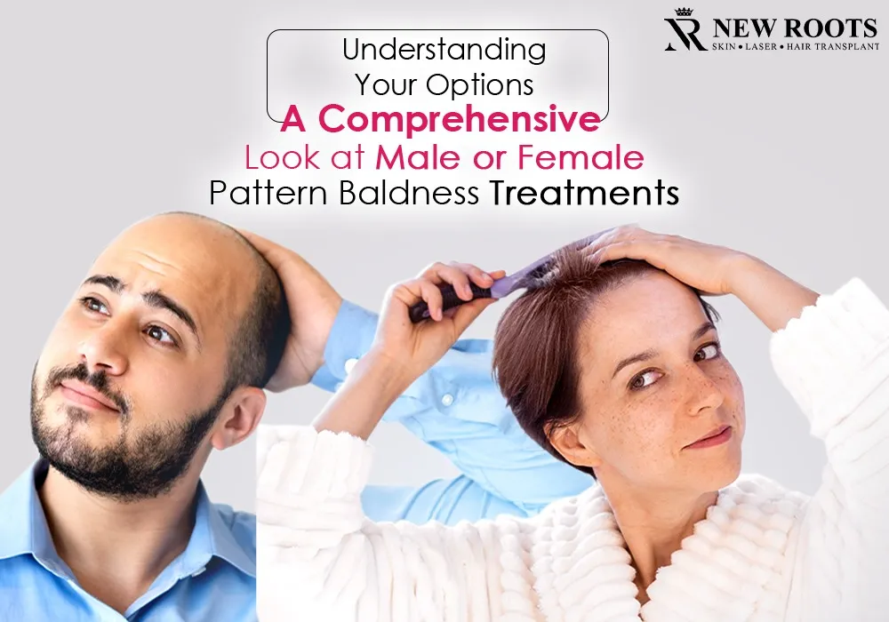 male or female pattern baldness treatments