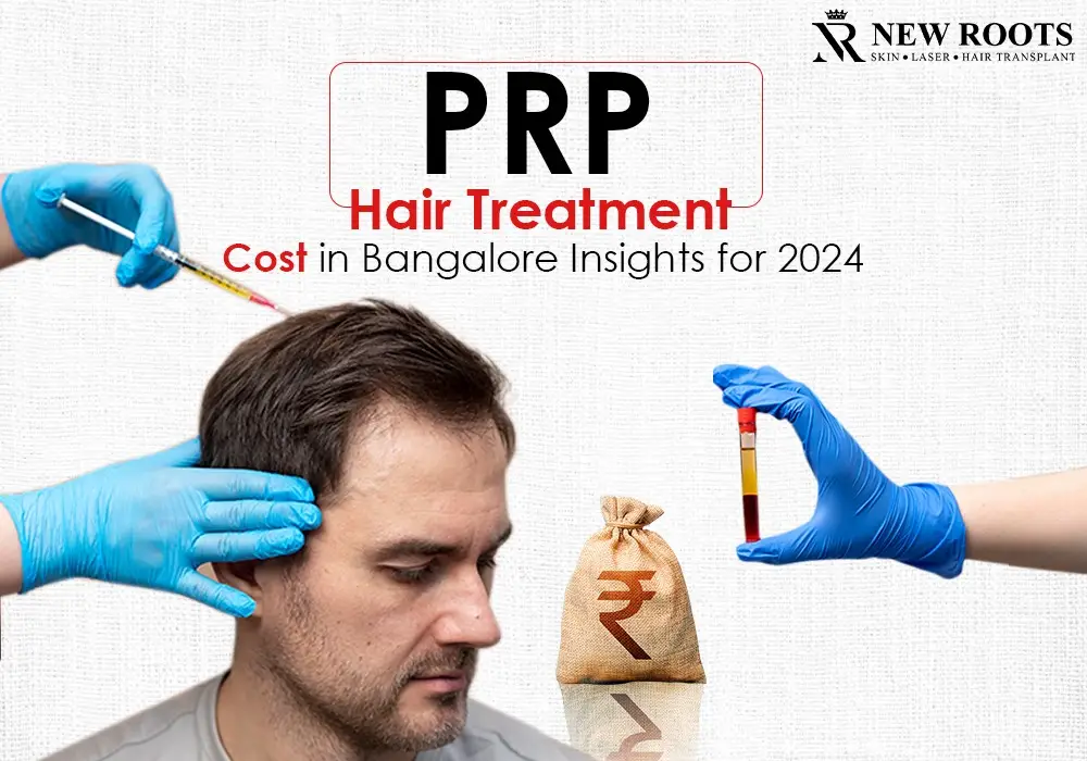 prp hair treatment cost in bangalore