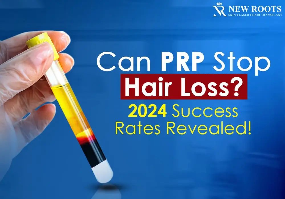 prp hair treatment success rate 2024