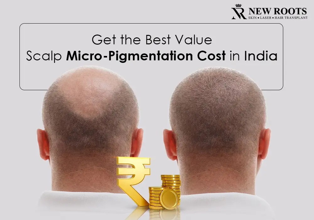 scalp micropigmentation cost in india