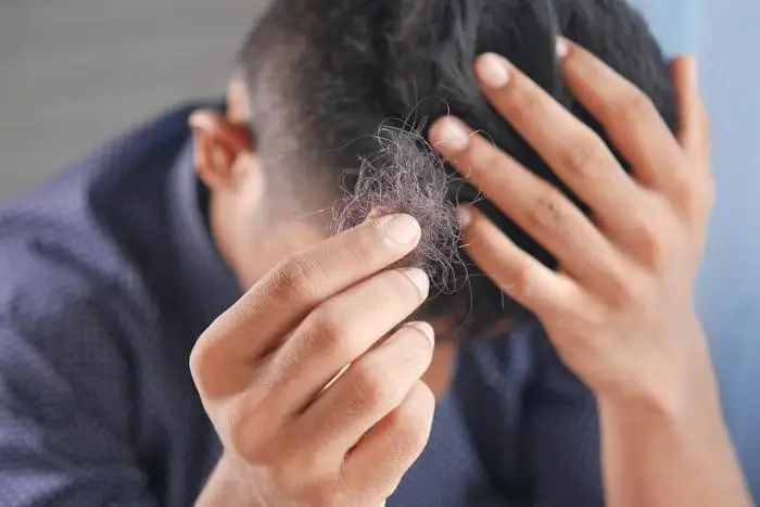 does sweating cause hair loss