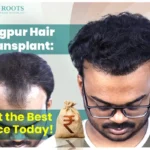 Hair Transplant Price in Nagpur