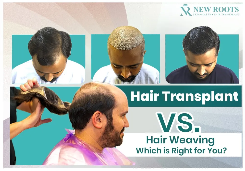 Hair Weaving vs Hair Transplant