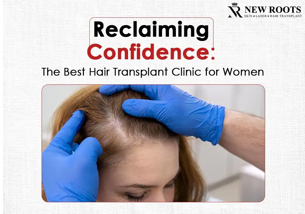 best hair transplant clinic for women