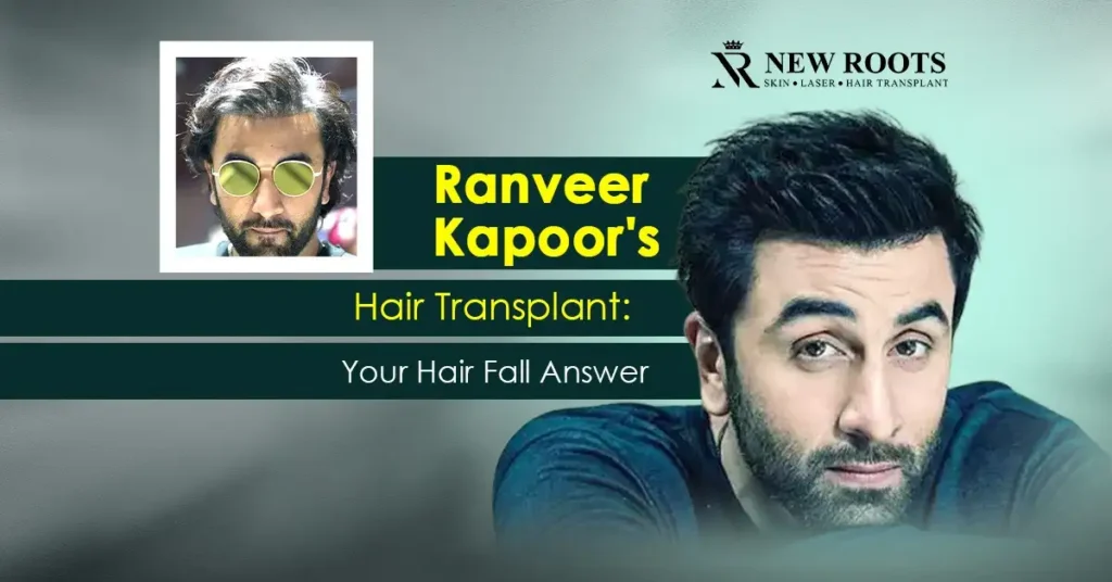 Ranbir Kapoor Hair Transplant