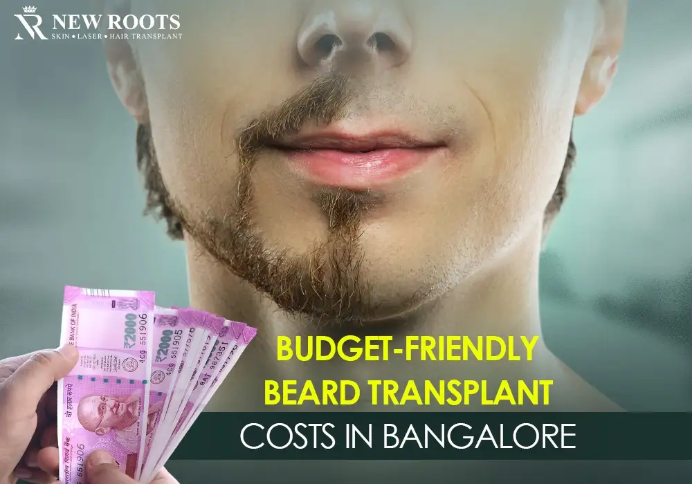 beard transplant cost in Bangalore