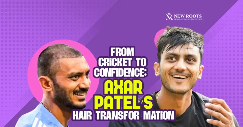 Axar Patel hair transplant