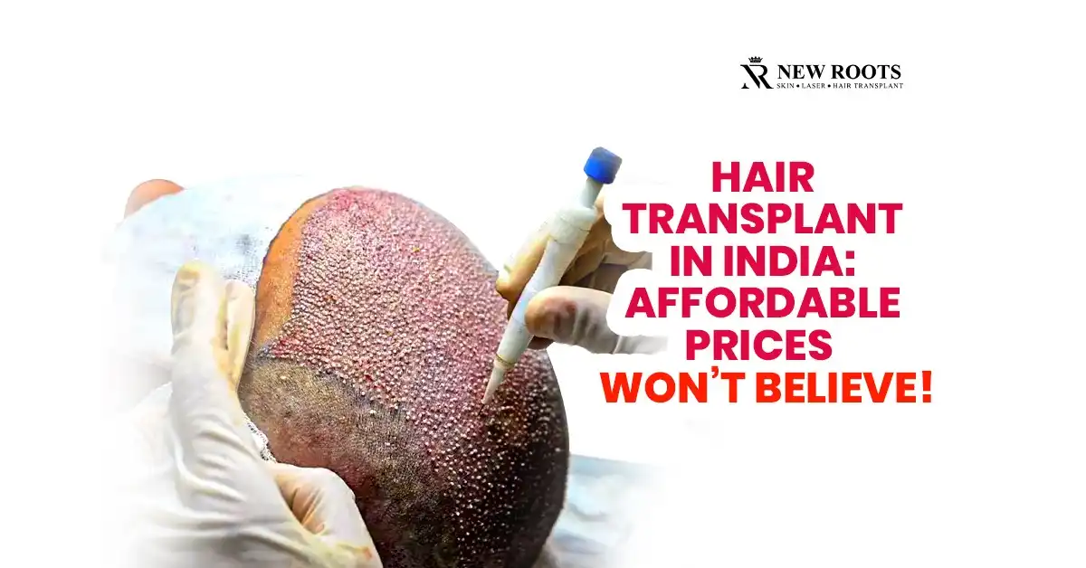 Hair Transplant Cost in India