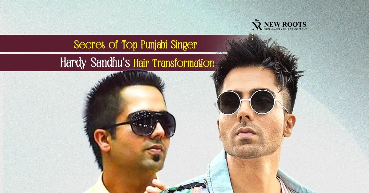 Hardy Sandhu Hair Transplant