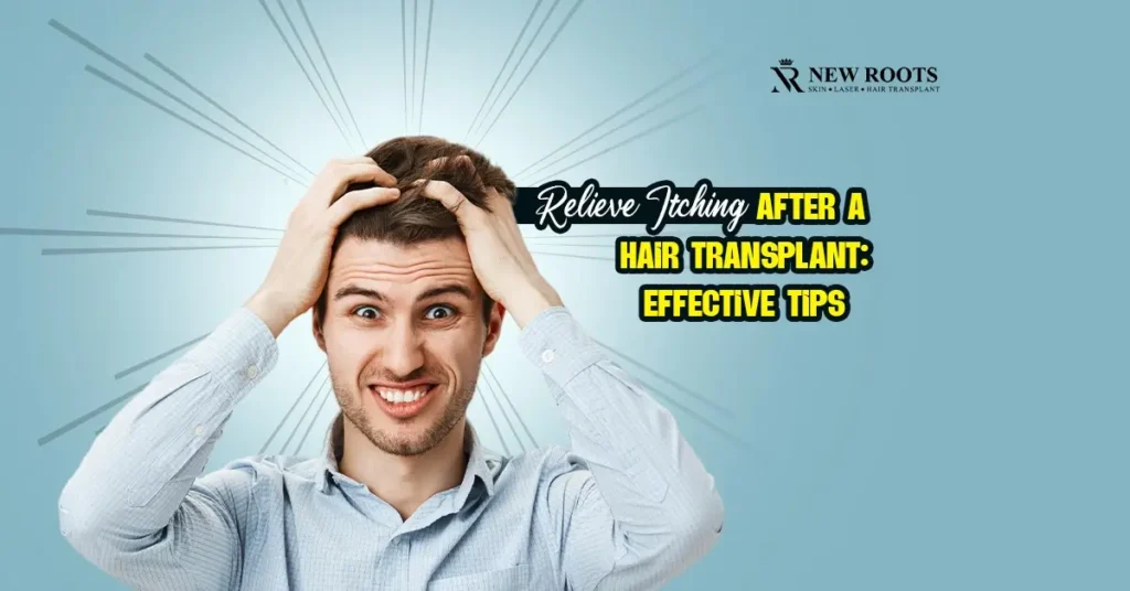 How to stop itching after a hair transplant?