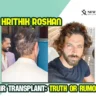 Hrithik Roshan hair transplant