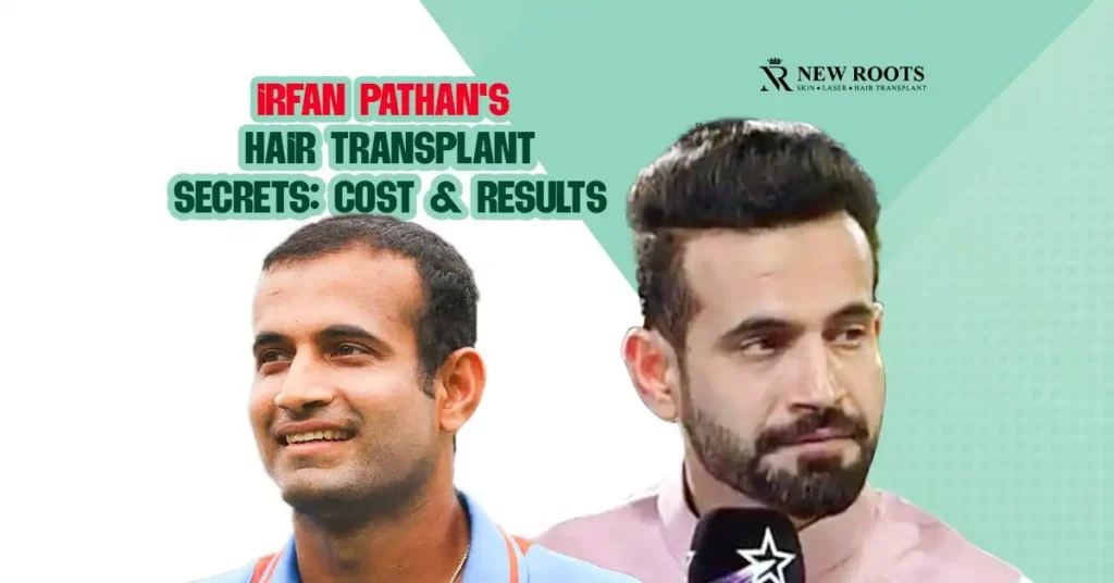 Irfan Pathan hair transplant