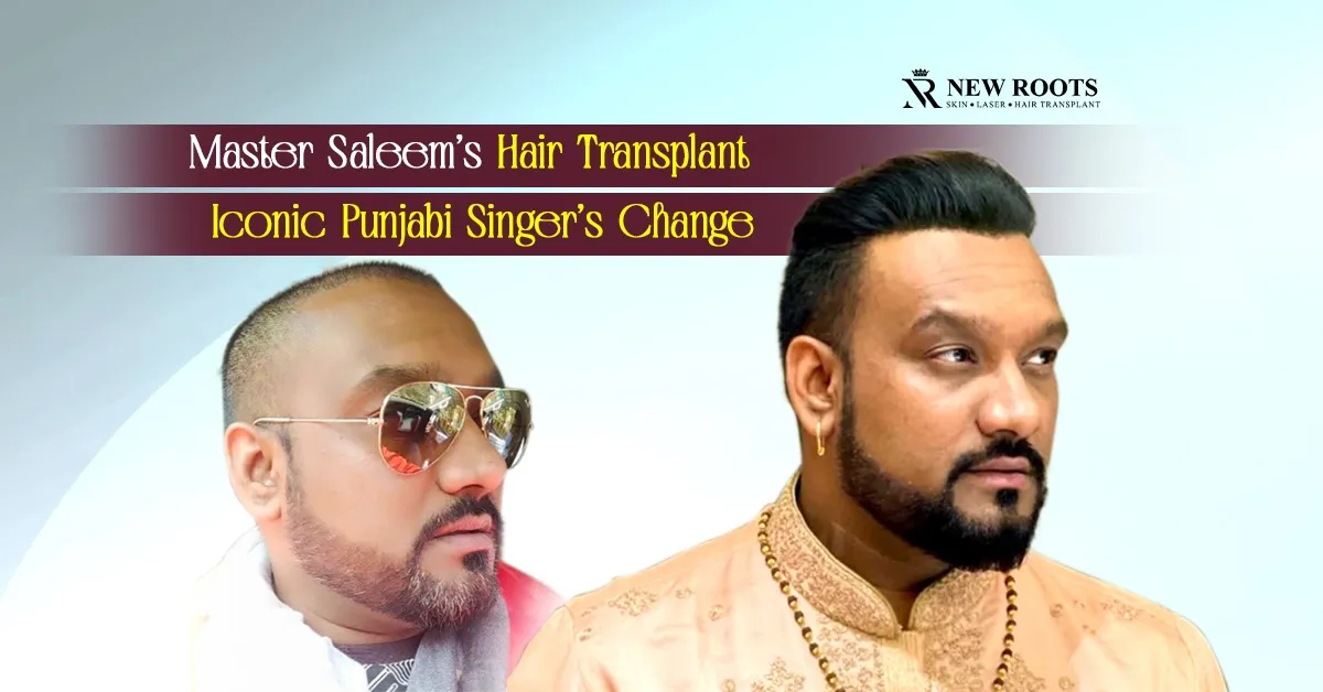 Master Saleem Hair Transplant