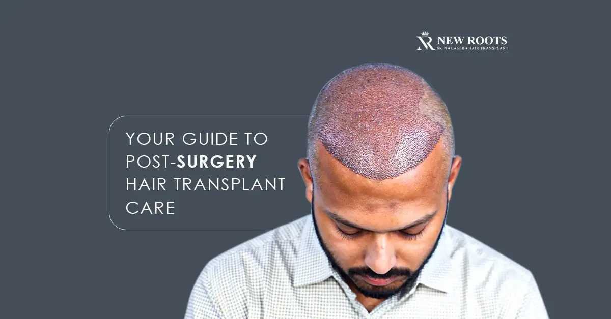 How To Take Care After Hair Transplant Surgery?