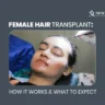 Female Hair Transplant