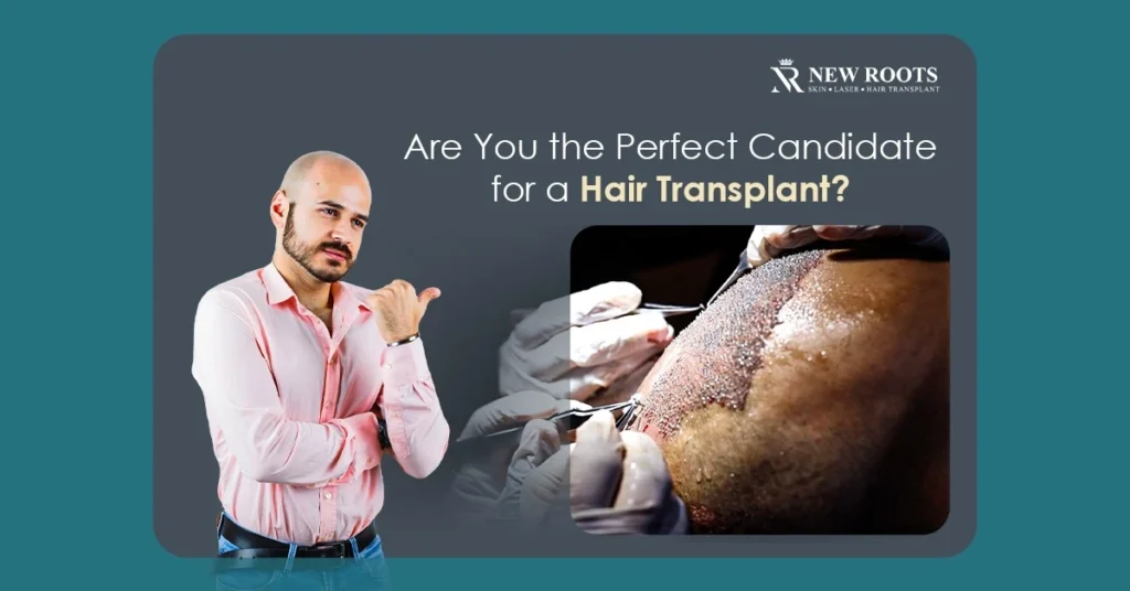 Ideal Candidate for Male Hair Transplant