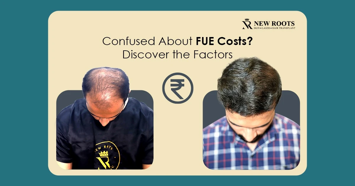 Factors That Influence FUE Hair Transplant Cost: A State-by-State Breakdown