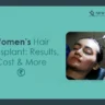 hair transplant for women