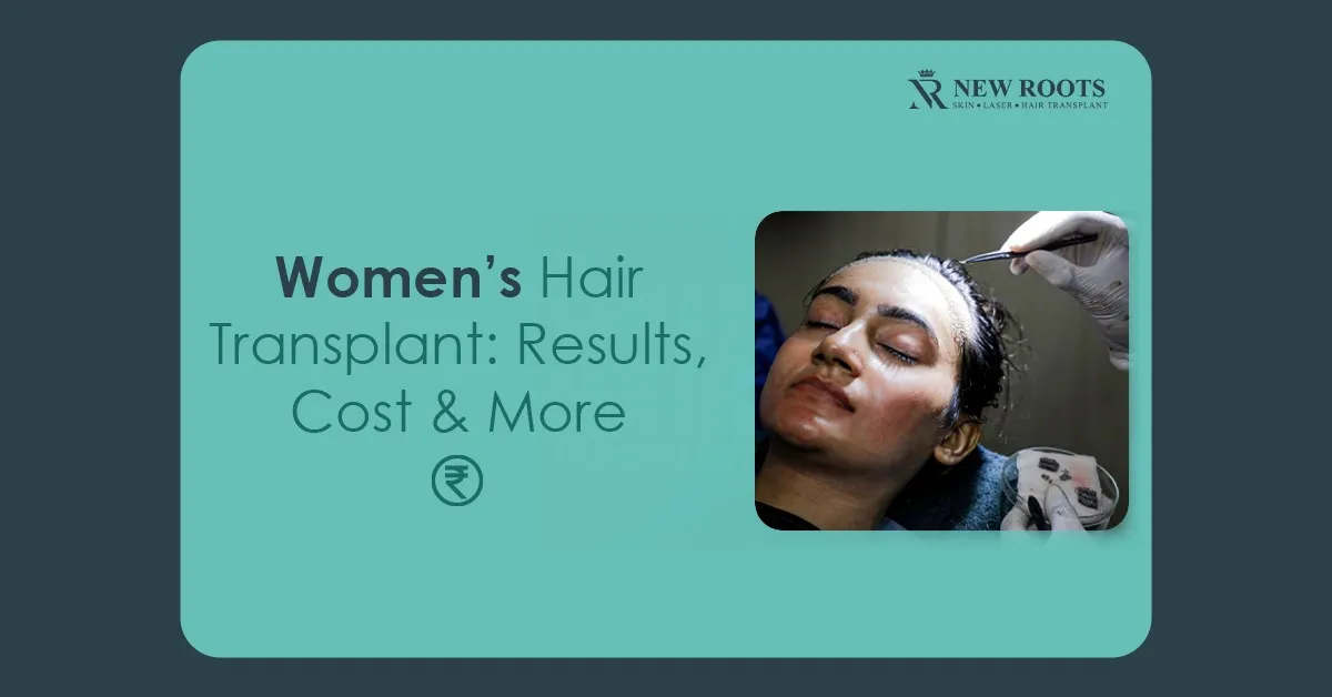 hair transplant for women