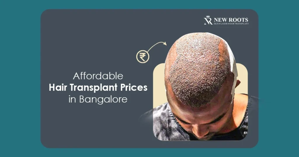 hair transplant price in Bangalore