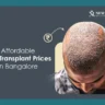 hair transplant price in Bangalore