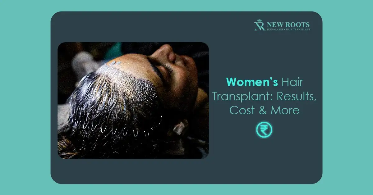 hair transplant for women