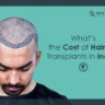 hairline transplant cost in India