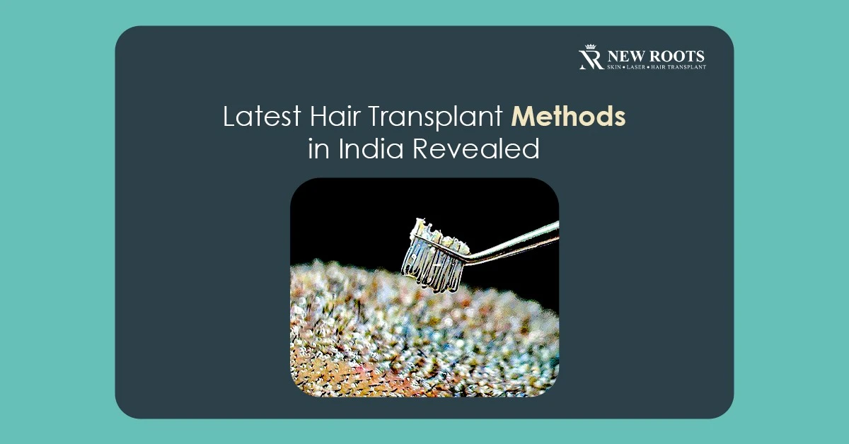 latest hair transplant technique in India