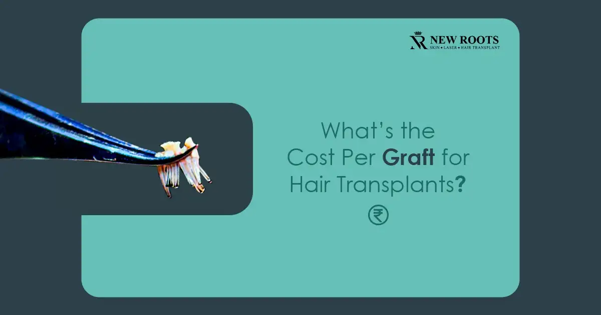 Hair transplant cost per graft