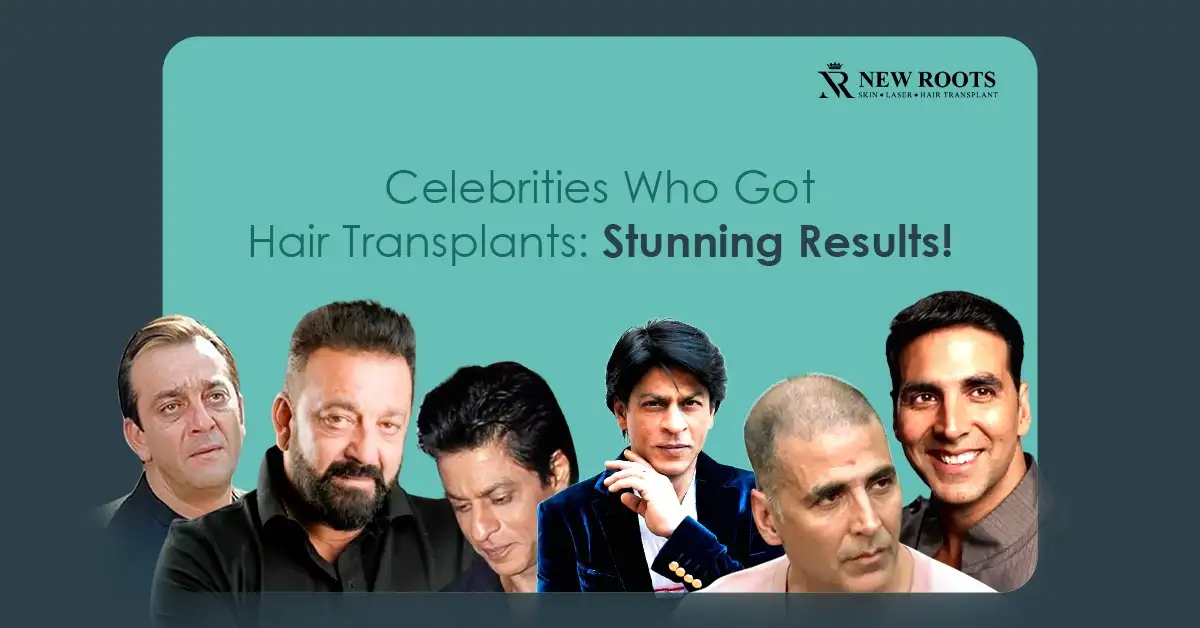 celebrity hair transplants pictures