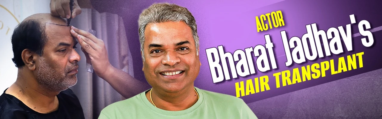 Actor Bharat Jadhav’s Hair Transplant - DV