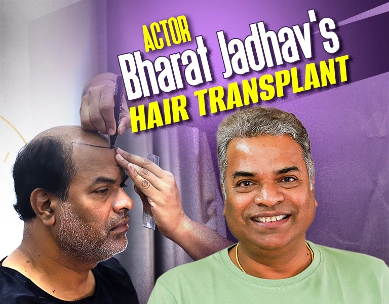 Actor Bharat Jadhav’s Hair Transplant - MV