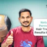 hair transplant results in Nashik