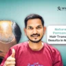 hair transplant results in Nashik