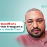 side effects after hair transplant