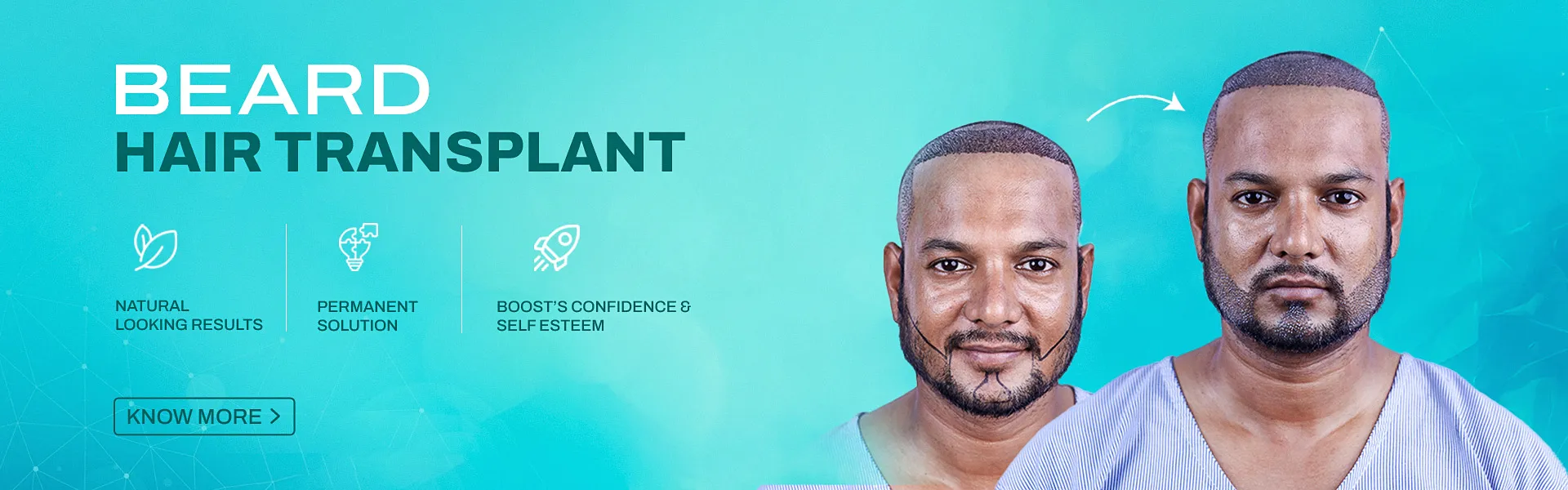 Beard HT DV - Banner (NP)