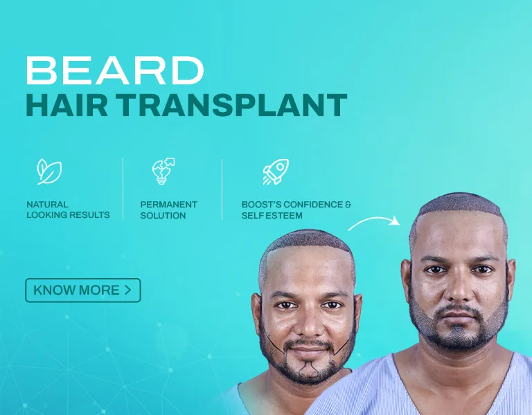 Beard HT MV - Banner (NP)